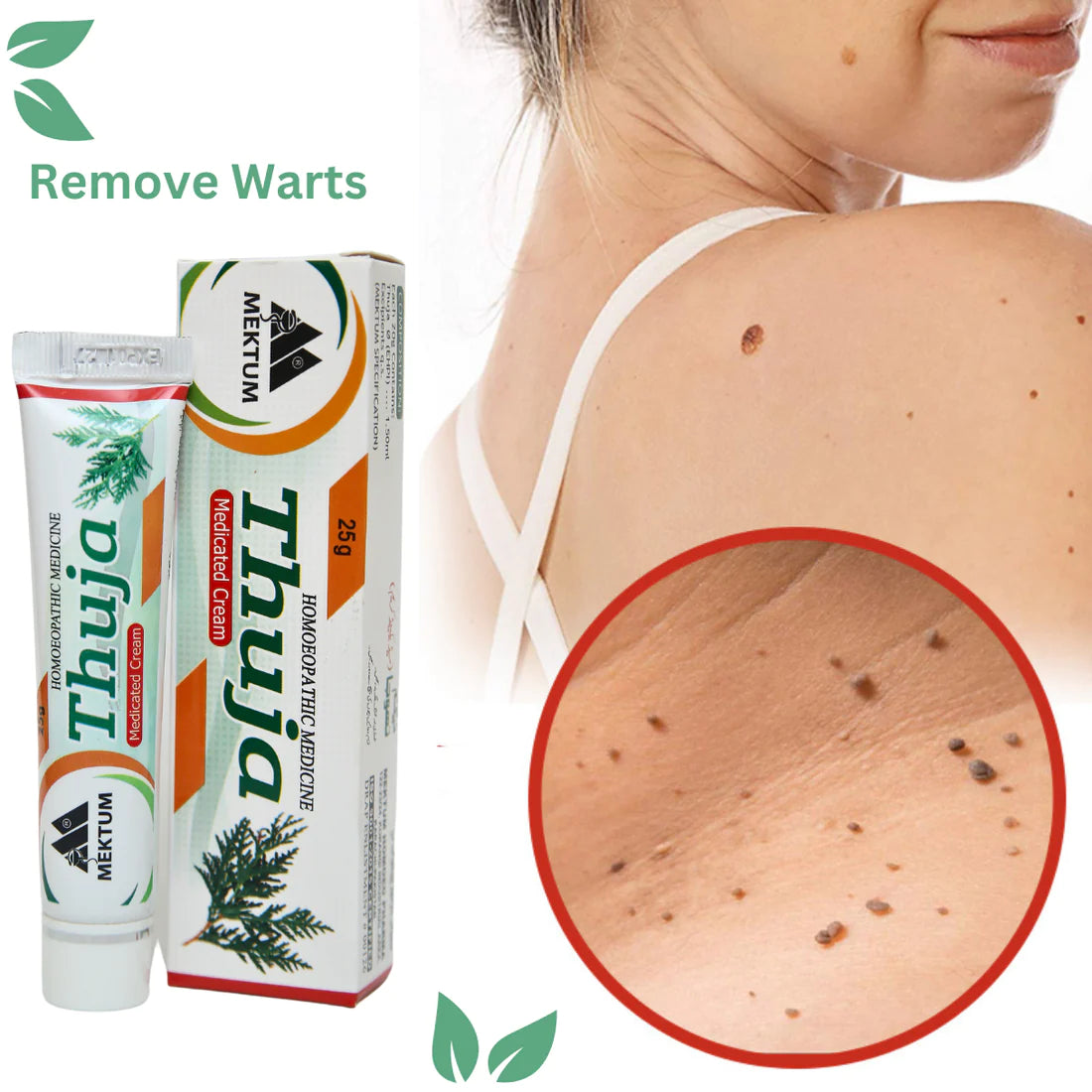 Warts and Moles Removal Treatment Cream Crazy Things