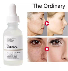 The Ordinary Vico Face Serum with Niacina-mide 10% +Zinc 1% 30ml Crazy Things