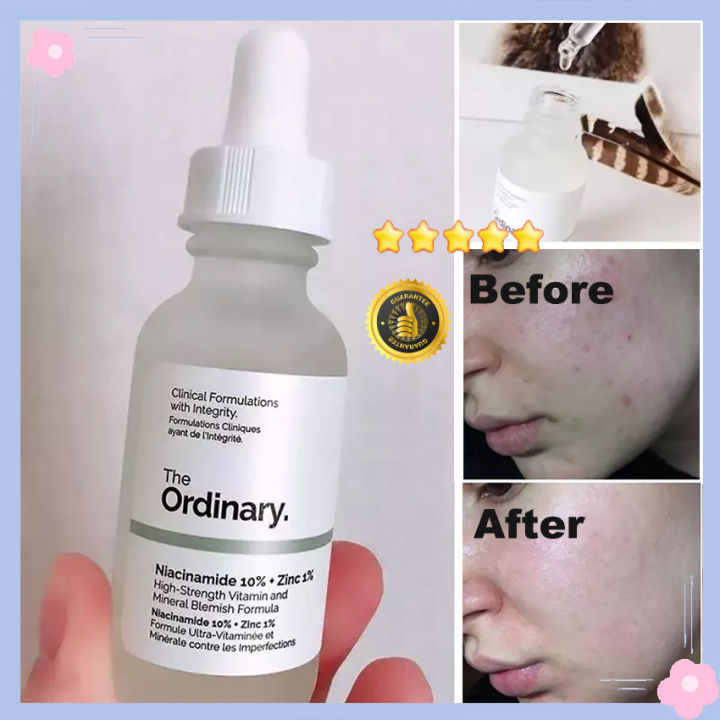 The Ordinary Vico Face Serum with Niacina-mide 10% +Zinc 1% 30ml Crazy Things