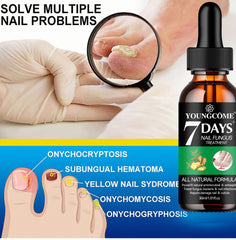 Nail Fungus Removal Serum Crazy Things